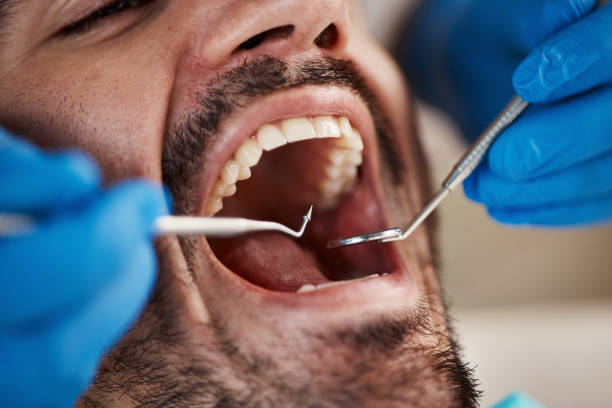 Best Emergency Root Canal Treatment in South Burlington, VT